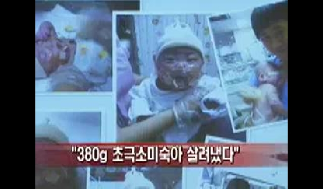  삼성서울병원, 380g 초극소미숙아 살려냈다